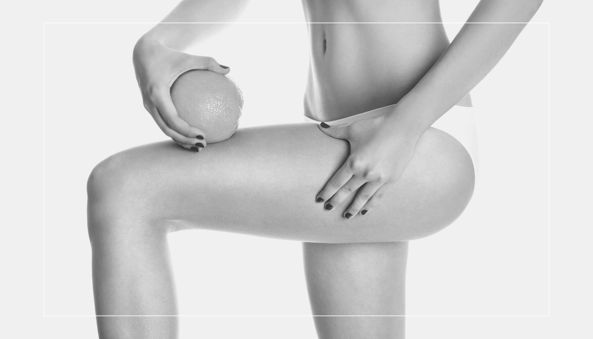 Cellulite e alimentazione